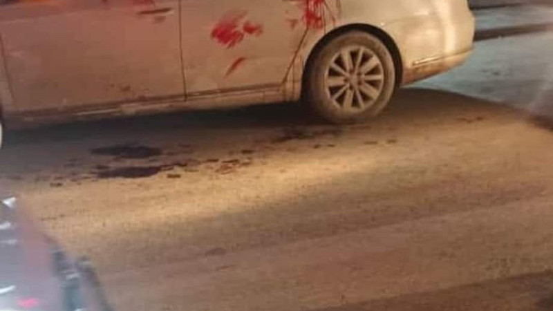Şanlıurfanın Suruç ilçesinde iki grup arasında çıkan silahlı kavga sonucunda 1 kişi hayatını kaybeti